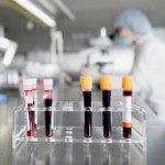 ЕСПЧ обязал Украину выплатить 6 тыс. евро за анализ крови